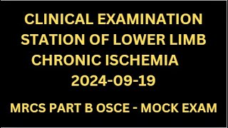 CLINICAL EXAMINATION STATION OF LOWER LIMB CHRONIC ISCHEMIA [upl. by Minny]