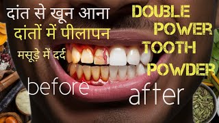 teeth problem double power tooth powder ayurvedColgate tooth powderdouble power tooth affzanish [upl. by Haila]