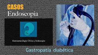 Gastropatía diabética [upl. by Atiuqcaj992]