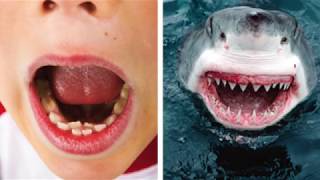 DoubleParked Teeth In Children Shark Teeth [upl. by Truscott466]