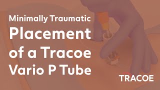 Minimally Traumatic Tube Placement of a Tracoe Vario P tube  Percutaneous Dilation Tracheostomy [upl. by Anallese596]