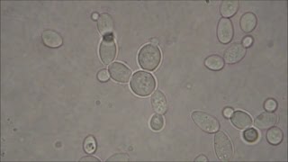 Bakers Yeast under the Microscope [upl. by Anoif]