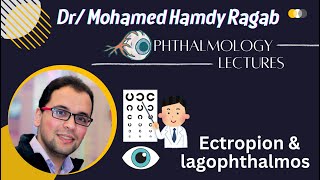 Eyelid 4  Ectropion amp lagophthalmos [upl. by Swope912]