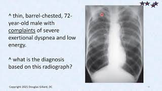 Chronic Bronchitis  Asthma  Emphysema The COPD Triad [upl. by Angelika]