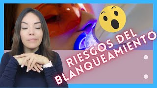 TODO lo que QUE TIENES que saber ANTES de tu BLANQUEAMIENTO dental [upl. by Latashia]