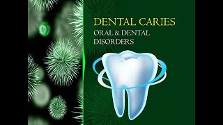 Dental Caries Lecture [upl. by Manthei]