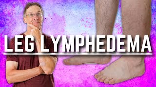 Top 3 Exercises for Leg Lymphedema Swelling or Edema [upl. by Aliuqet]