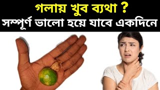 গলায় ব্যথা হলে কি করা উচিতgola betha hole ki korboHome Remedies for Sore Throatpts [upl. by Kuo]