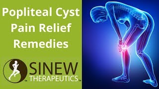 Popliteal Cyst Pain Relief Remedies [upl. by Nevs896]