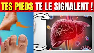 COMMENT vos PIEDS VOUS ALERTENT SUR DES PROBLÈMES HÉPATIQUES ET DE SANTÉ [upl. by Gleda]