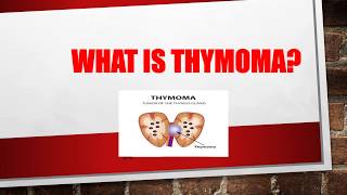 What is Thymoma  What causes thymoma  Thymoma symptoms  Thymoma treatment [upl. by Dougie483]