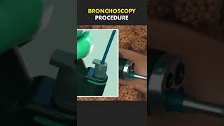 bronchoscopy procedure bscnursing ytshorts medicalstudent doctor lungs nursing [upl. by Avlis]