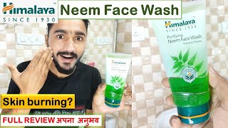 himalaya neem face wash  Uses Benefitsamp How to Apply  himalaya face wash  face wash for pimples [upl. by Htieh859]