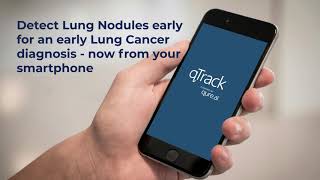 qTrack for Lung Nodules  EndtoEnd Disease Management using Artificial Intelligence Algorithms [upl. by Eleanor]