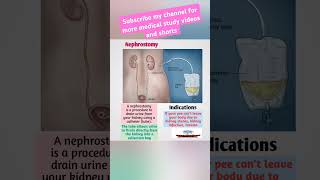 NephrostomyFreeMedicalEducationld3sfnursingmedicalviralviralshortsvideoyoutubeviralshorts [upl. by Miki293]