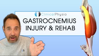 Gastrocnemius Calf Injury and Strain  Expert Explains Mechanism Of Injury and Rehab Plan [upl. by Aicirtel]