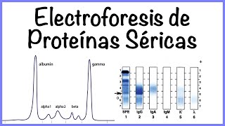 Electroforesis de Proteínas Séricas [upl. by Seldon485]