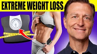 The Ultimate Fat Burning Guide Dr Bergs Webinar on Maximum Weight Loss [upl. by Ewald]