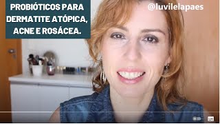 PROBIÓTICOS para DERMATITE ATÓPICA ACNE e ROSÁCEA [upl. by Sukcirdor655]