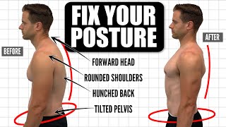 How To FIX Your Posture  10Minute Daily Routine [upl. by Corella]