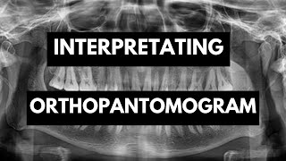 Interpretation of Orthopantomogram OPG In Detail [upl. by Aenert941]