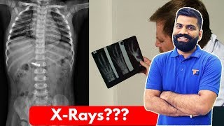 XRays The Powerful Waves XRays Explained [upl. by Nodnrb]