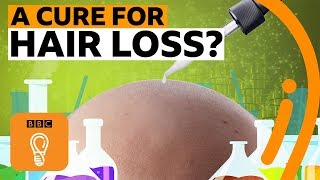 Why is there no cure for hair loss  BBC Ideas [upl. by Kirbie]