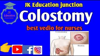 Colostomycolostomy in hindicolostomy for nursesbest vedio for nurses [upl. by Yolande]