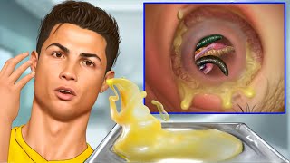 ASMR Remove Blackheads Pustules amp Parasitic Maggots Ear  Deep Cleaning Animation [upl. by Boyden146]