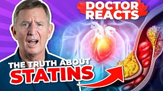 ARE WE TREATING CHOLESTEROL WRONG  Doctor reacts [upl. by Yt361]