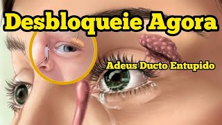 Exercícios Para Consertar Um Ducto Lacrimal Bloqueado Sem Fazer Cirurgia [upl. by Yojal]