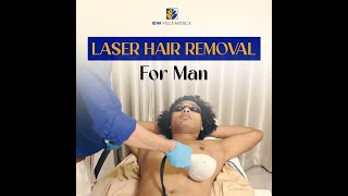 Laser Hair Removal For Men Patient Review [upl. by Inerney]