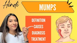 Mumps  Symptoms diagnosis Treatment  Explained easily in Hindi [upl. by Calypso]