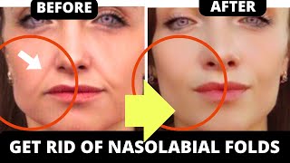 🛑 HOW TO LIFT SMILE LINES  GET RID OF LAUGH LINES WITH FACE YOGA  JOWLS SAGGY SKIN JAWLINE [upl. by Nilauqcaj127]