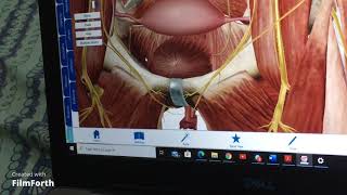 MODIFICATION OF HYPOGASTRIC SHEATH PART 2 AND FEMALE OPELVIS FASCIA [upl. by Leirza]