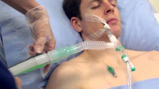 Using Intersurgicals TrachSeal™ closed suction systems [upl. by Alysoun]