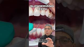 How Invisalign Can Fix Minimal Crowding of Teeth  View Mobile Dental shorts [upl. by Clute312]