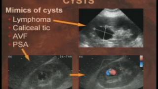 Practical Reviews in Ultrasound Kidneys amp Adrenals [upl. by Zahavi]