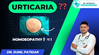 quotRelief from Urticaria Homeopathic Medicine by Dr Sunil Patidarquot [upl. by Garald693]