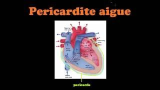 SmartNEasy Cardio  Pericardite Aigue  Dr Astuce [upl. by Jackie]