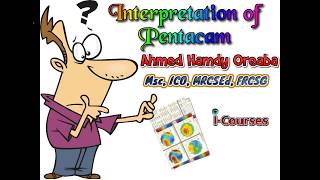 Pentacam Interpretation English [upl. by Nitsu586]