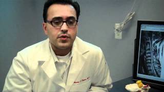 Meridian Neuroscience Cervical Spondylotic Myelopathy CSM Aasim S Kazmi MD [upl. by Lonni]