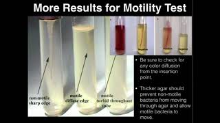 Microbiology Motility Test [upl. by Dnalor]