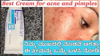 Benzoyl Peroxide Gel 25  Uses Side Effect Full Review In Kannada ಮೊಡವೆಯನ್ನು ಮುಕ್ತ ಗೊಳಿಸುವ ಕ್ರೀಮ್ [upl. by Aliac675]