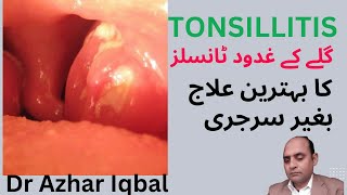 tonsilitis treatmentटॉन्सिलिटिस उपचार WITH HOMOEOPATHIS MEDICINEURDU HINDIDR AZHAR IQBAL [upl. by Nikaniki]