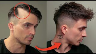 6 Brilliant Hairstyles To Hide Receding Hair amp Big Foreheads [upl. by Benia102]