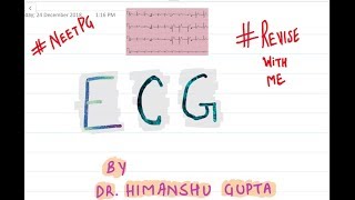 ECG MADE SIMPLE AND EASY  DR HIMANSHU GUPTA  NEET PG [upl. by Manoop]