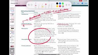 Oligodendroglioma neurology 125  First Aid USMLE Step 1 in UrduHindi [upl. by Eicul]