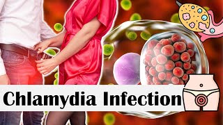 Chlamydia Infection  Causes Risk Factors Transmission Signs amp Symptoms Diagnosis amp Treatment [upl. by Mcgray]