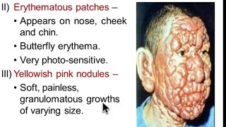 Kala Azar  Leishmania  Sleeping sickness  Trypanosoma  MICROBIOLOGY [upl. by Ogawa]